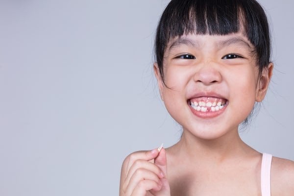 Niềng răng ở trẻ em và những điều cần biết | Vinmec