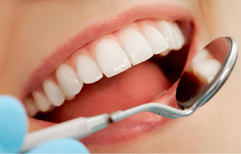 Lựa chọn sử dụng loại răng sứ nào tùy thuộc vào nhu cầu và khả năng của mỗi người