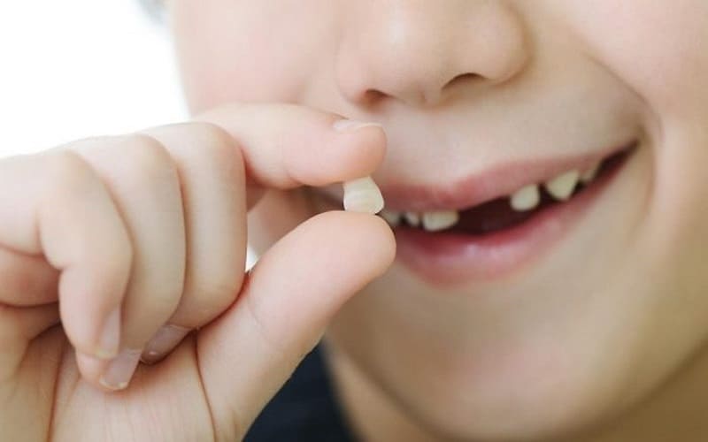 Nhổ răng trẻ em và những điều cần biết